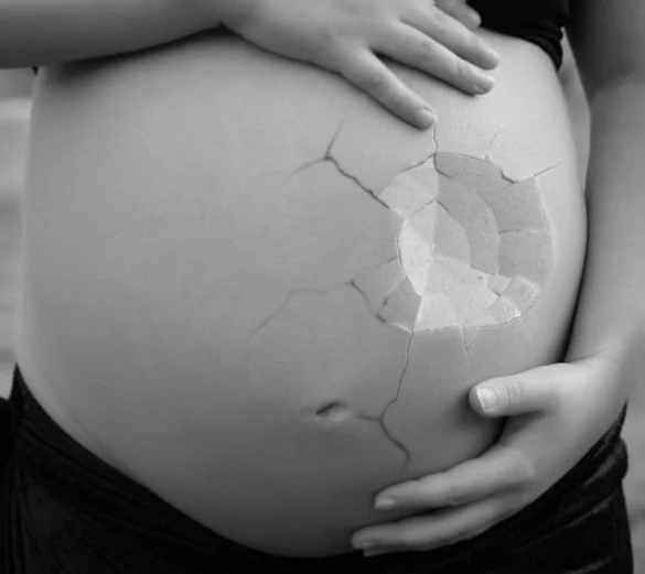 Soñar con un aborto espontaneo Soñar con un aborto espontaneo